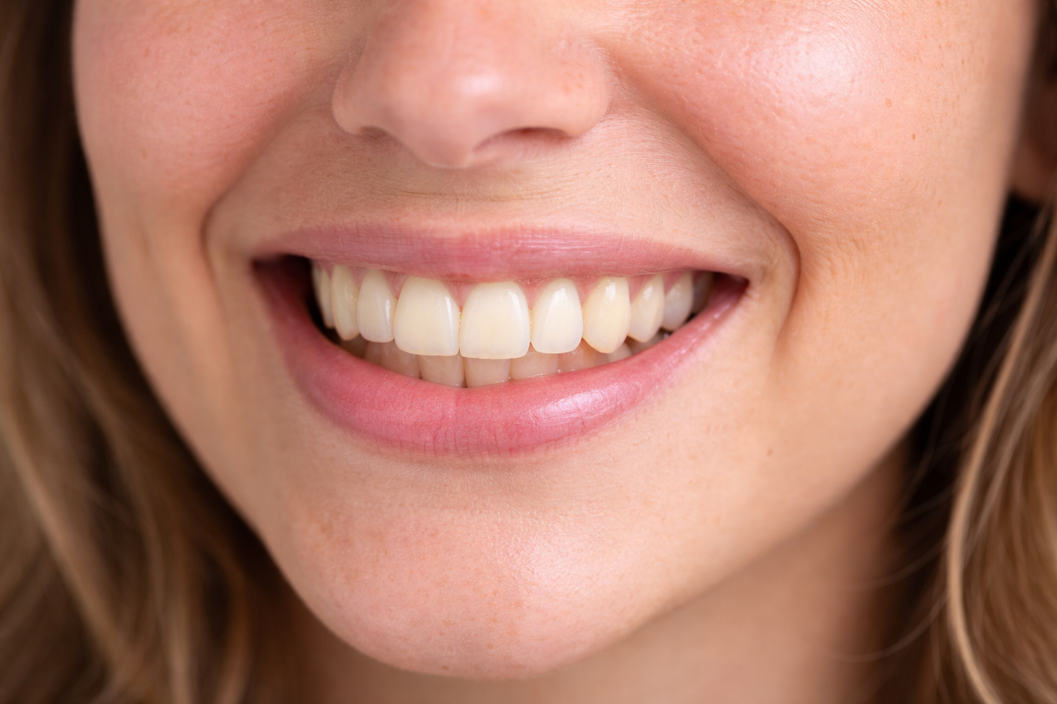 Purple Whitening Strips - Nivera Smile