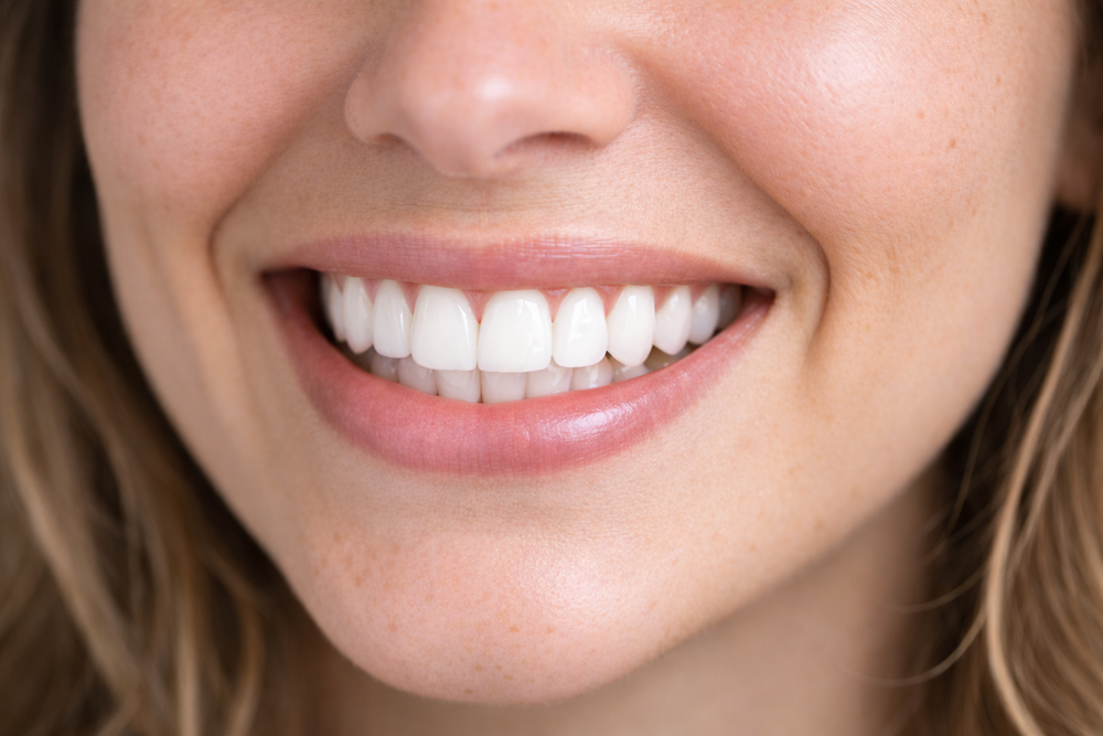 Purple Whitening Strips - Nivera Smile