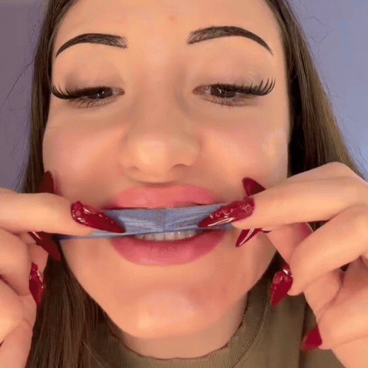Purple Whitening Strips – Nivera Smile